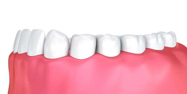 Zahnfleisch Und Zähne Medizinisch Korrekte Abbildung Der Zähne — Stockfoto