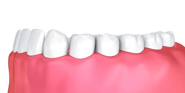 Gomme Masticare Denti Illustrazione Del Dente Clinicamente Accurata — Foto Stock