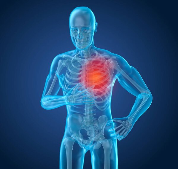 Heart Attack, man suffering from heart pain. 3D illustration