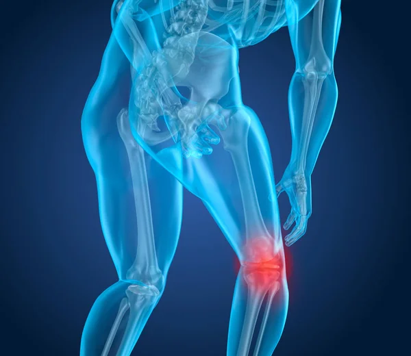 Knee Pain Attack Man Suffering Spinal Knee Illustration — Stock Photo, Image