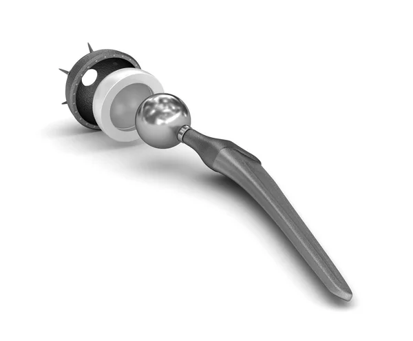 Implante Reemplazo Cadera Aislado Blanco Ilustración Médicamente Precisa — Foto de Stock