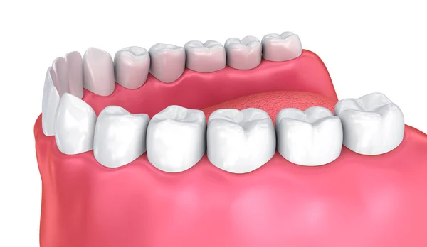 Jamy Ustnej Dziąseł Zębów Ilustracja Medycznie Zęba — Zdjęcie stockowe