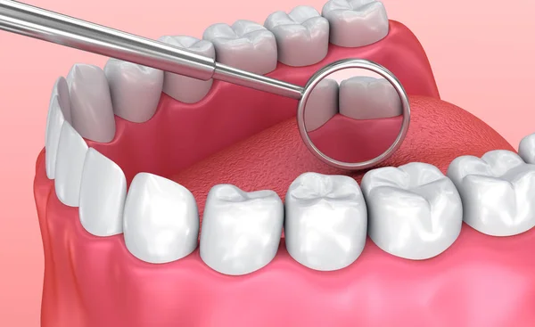 Teeth inspection with mirror. Medically accurate tooth 3D illustration