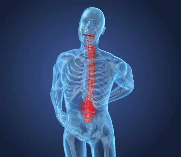 Dolor Espinal Ataque Hombre Que Sufre Dolor Espinal Ilustración —  Fotos de Stock