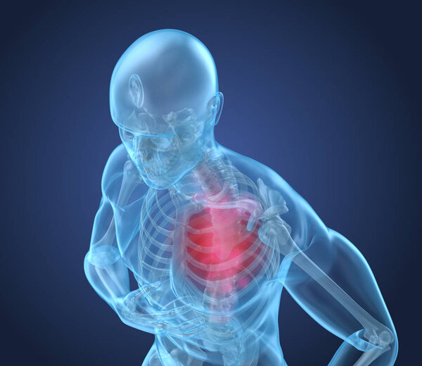 Heart Attack, man suffering from heart pain. 3D illustration