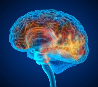 İnsan beyin tümörü X-ray tarama, tıbben doğru 3d çizim