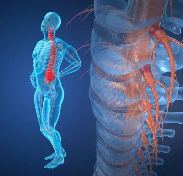 脊髄の痛み攻撃 脊髄の痛みから苦しんでいる人 イラストレーション — ストック写真