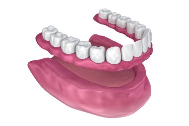 Tüm eksik diş - çıkarılabilir tam protez. 3D çizim