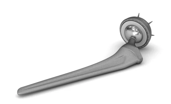 人工股関節置換術インプラントは 白で隔離 医学的に正確な イラスト — ストック写真
