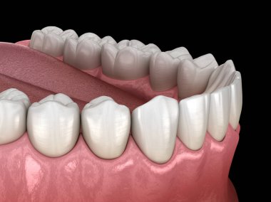 İnsan çikleti ve dişleri. Tıbbi olarak doğru diş 3D illüstrasyon