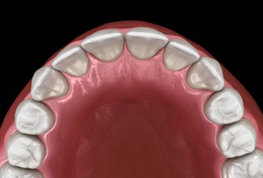 Büyük insan sakızı ve dişleri. Tıbbi olarak doğru diş 3D illüstrasyon