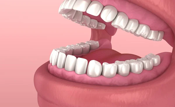 Mouth Gum Teeth Medically Accurate Tooth Illustration — Stock Photo, Image