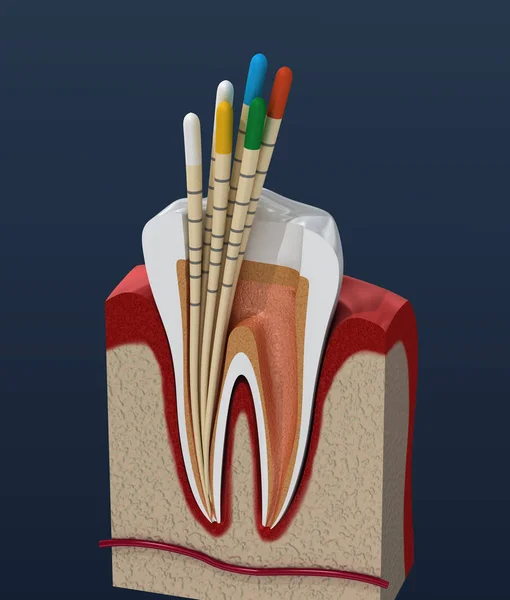 古塔栖息内淋病仪器 牙科解剖学 — 图库照片