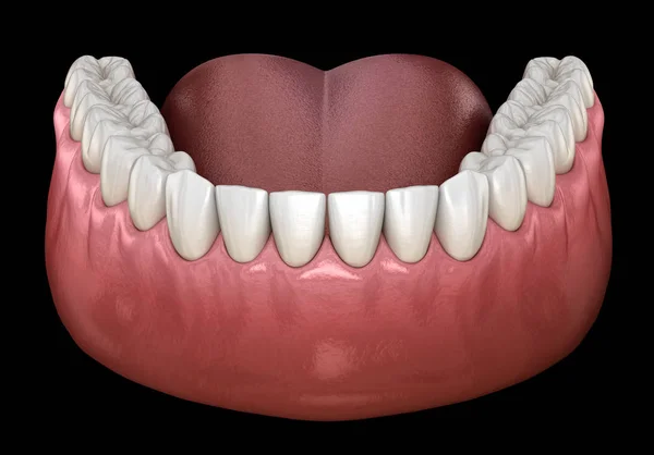 Goma Dientes Humanos Mandibulares Ilustración Dientes Médicamente Precisos —  Fotos de Stock