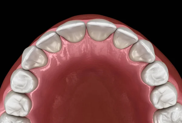 Maxillary human gum and teeth. Medically accurate tooth 3D illustration