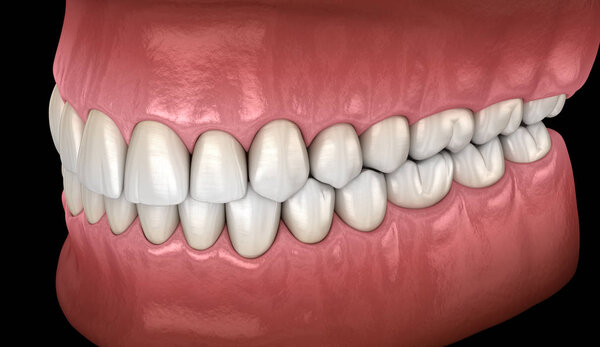 Healthy human teeth with normal occlusion, side view. Medically accurate tooth 3D illustration
