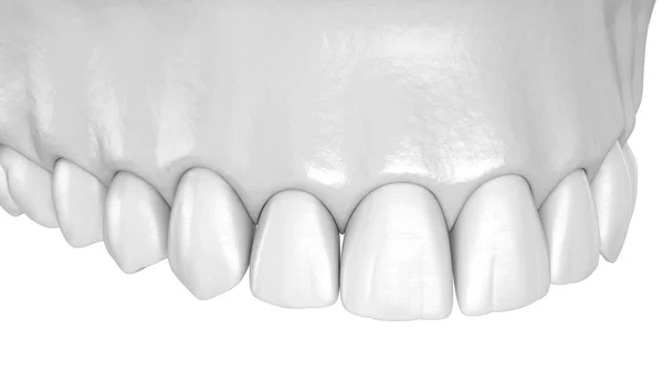 Oberkiefer Zahnfleisch Und Zähne Medizinisch Korrekte Darstellung Der Zähne — Stockfoto