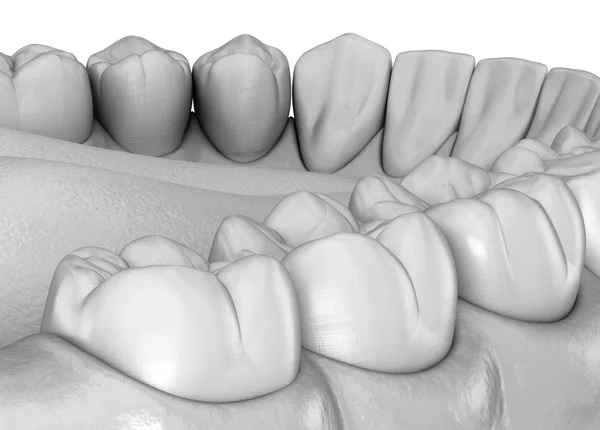 Mandibulaire Humane Gom Tanden Anatomie Medisch Nauwkeurige Tand Illustratie — Stockfoto