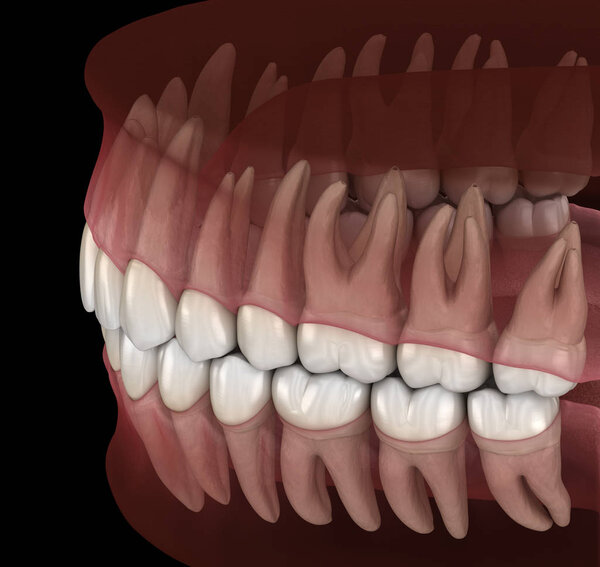 Morphology of mandibular and maxillary human gum and teeth. Medically accurate tooth 3D illustration