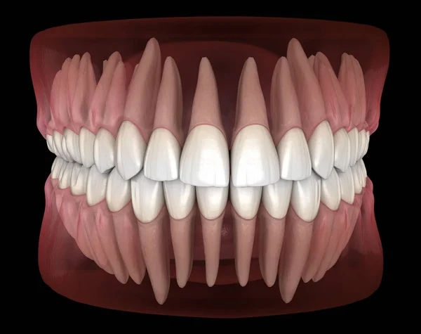 Morfologia Żuchwy Szczękowej Ludzkiej Gumy Zębów Medycznie Dokładna Ilustracja Zębów — Zdjęcie stockowe
