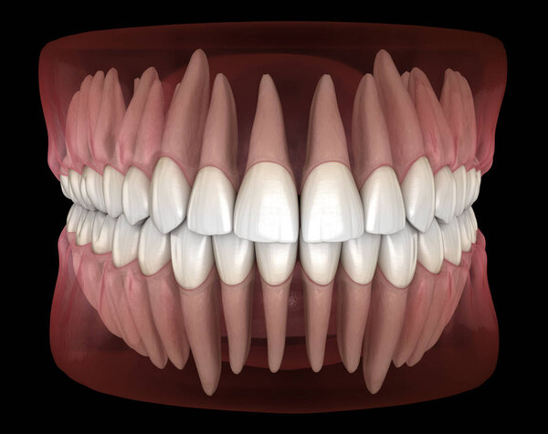 Morphology of mandibular and maxillary human gum and teeth. Medically accurate tooth 3D illustration