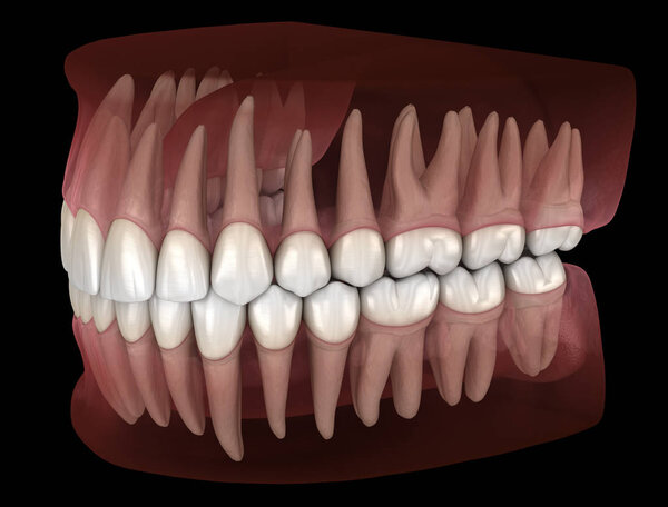 Morphology of mandibular and maxillary human gum and teeth. Medically accurate tooth 3D illustration