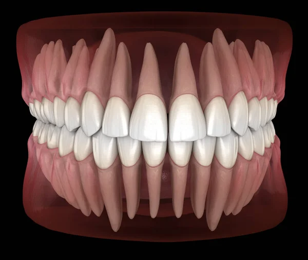 Morphologie Des Gencives Des Dents Humaines Mandibulaires Maxillaires Illustration Dentaire — Photo
