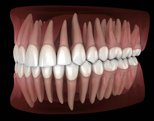 下颌和上颌人牙龈和牙齿的形态学 医学上精确的牙齿 — 图库照片