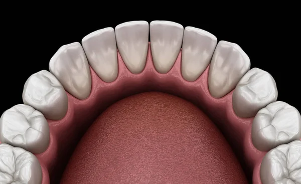 上颌人类的牙龈和牙齿 医学上准确的牙齿3D图像 — 图库照片