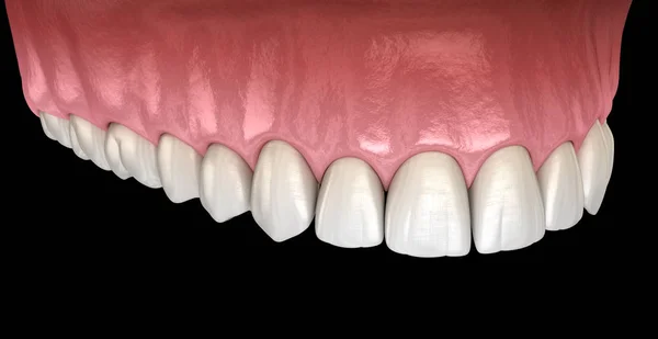 Guma Zęby Maxillary Medycznie Dokładna Ilustracja Zęba — Zdjęcie stockowe