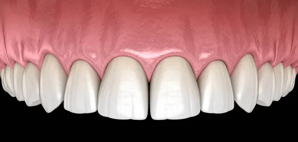 Gengiva Humana Maxilar Dentes Ilustração Dente Medicamente Precisa — Fotografia de Stock