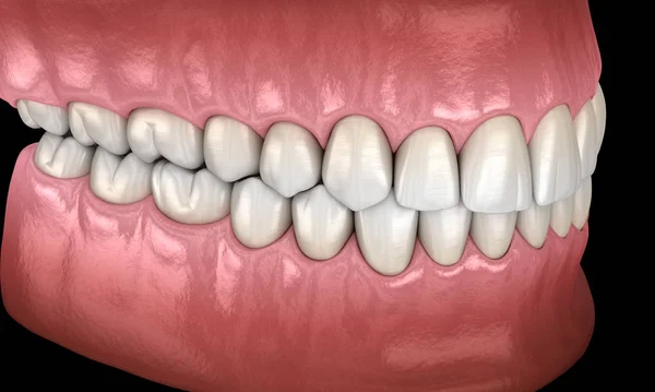 Dentes Humanos Saudáveis Com Oclusão Normal Visão Lateral Ilustração Dente — Fotografia de Stock