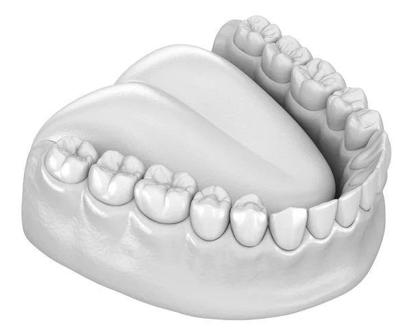 Anatomie Lidské Gumy Zubů Medově Přesný Zubní Zub Ilustrace — Stock fotografie