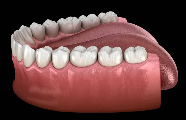 Mandibulair Menselijk Tandvlees Tanden Medisch Nauwkeurige Tand Illustratie — Stockfoto