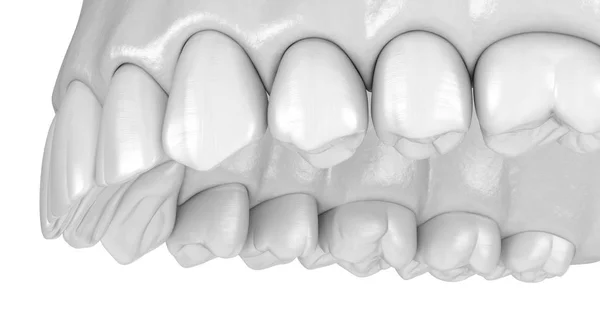 Gomme Denti Umani Maxillary Illustrazione Del Dente Clinicamente Accurata — Foto Stock