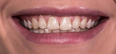 Woman smile with great natural teeth