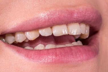 Woman smile with great natural teeth