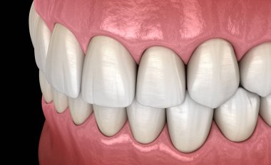 Normal tıkantılı sağlıklı insan dişleri, yan görünüm. Tıbbi olarak doğru diş 3d illüstrasyon