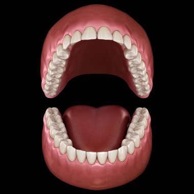 Diş anatomisi - Açık Protezler. Tıbbi olarak doğru diş 3d illüstrasyon
