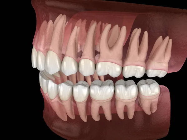Morfologie Mandikulární Maxilární Lidské Gumy Zubů Medově Přesný Zubní Zub — Stock fotografie