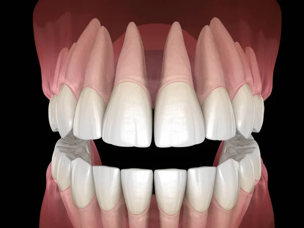 Morfología Las Encías Dientes Humanos Maxilares Mandibulares Ilustración Dientes Médicamente — Foto de Stock