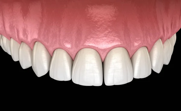 Gomme Denti Umani Maxillary Illustrazione Del Dente Clinicamente Accurata — Foto Stock