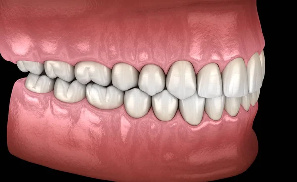 正常な閉塞 側面の眺めが付いている健康な人間の歯 医学的に正確な歯3Dイラスト — ストック写真