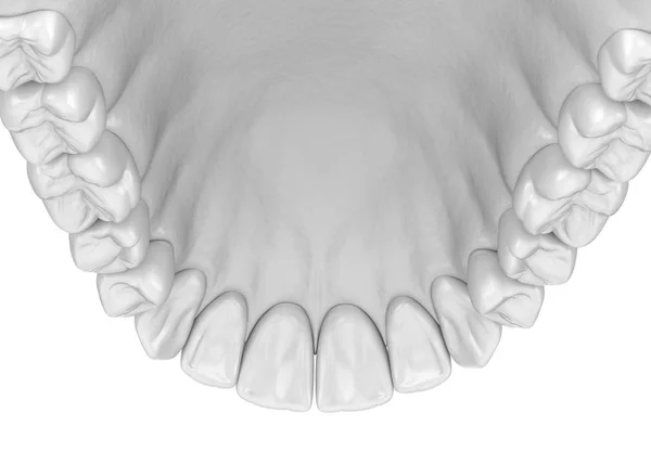 Goma Dientes Humanos Maxilares Ilustración Dientes Médicamente Precisos — Foto de Stock