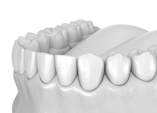 Goma Humana Mandibular Anatomía Los Dientes Ilustración Dientes Médicamente Precisos —  Fotos de Stock