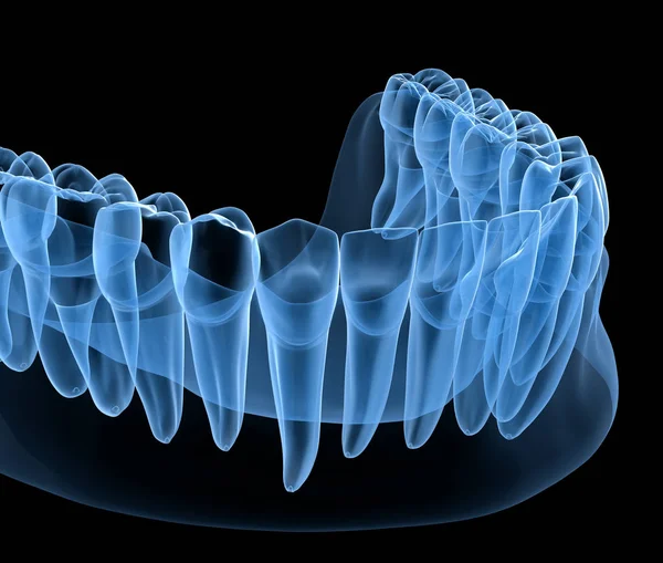 Anatomia Dentale Delle Gengive Dei Denti Umani Mandibolari Vista Raggi — Foto Stock