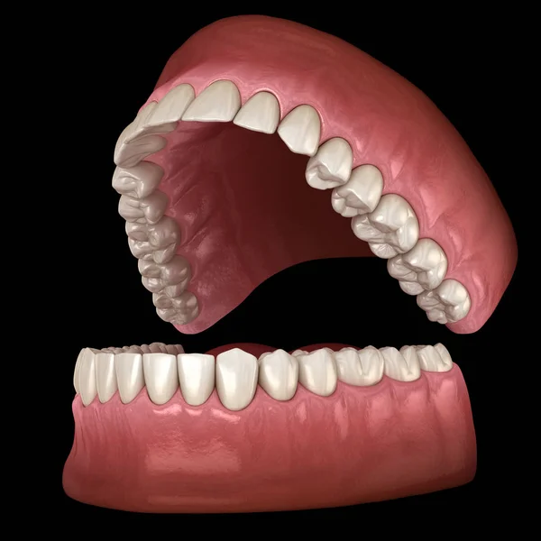 Tandheelkundige Anatomie Geopende Kunstgebitten Medisch Nauwkeurige Tandheelkundige Illustratie — Stockfoto