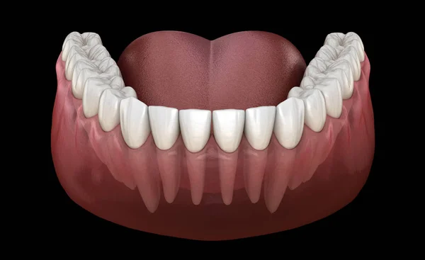 Morphologie Gencive Des Dents Humaines Mandibulaires Illustration Dentaire Médicalement Précise — Photo