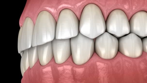 Здоровые человеческие зубы с нормальной окклюзией, вид сбоку. Медицинская точность 3D анимации зубов — стоковое видео