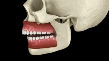 Overbite diş tıkanıklığı ( Diş maloklüzyonu ). Tıbbi olarak doğru diş 3d animasyon